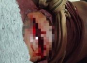 Cekcok Dengan Istrinya, Seorang Pria Asal Angata di Tebas Suami Iparnya