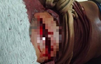 Cekcok Dengan Istrinya, Seorang Pria Asal Angata di Tebas Suami Iparnya