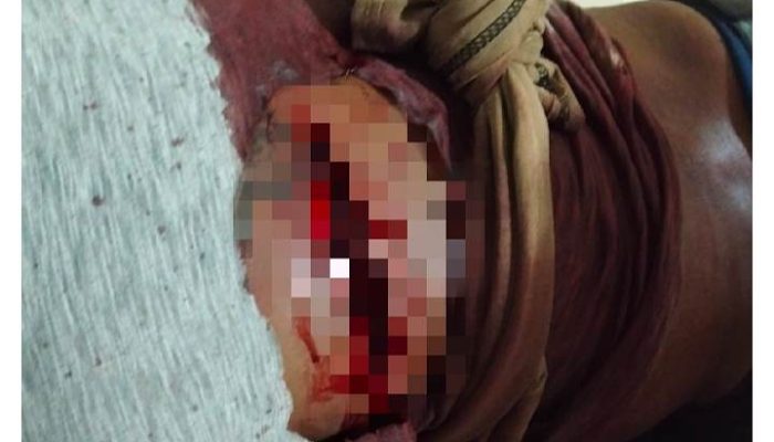 Cekcok Dengan Istrinya, Seorang Pria Asal Angata di Tebas Suami Iparnya