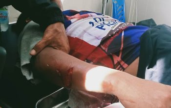 Karyawan PT MS Kembali Jadi Korban Pengeroyokan di Lahan PT.Marketindo Selaras Blok J.50 Satu Orang di Rujuk